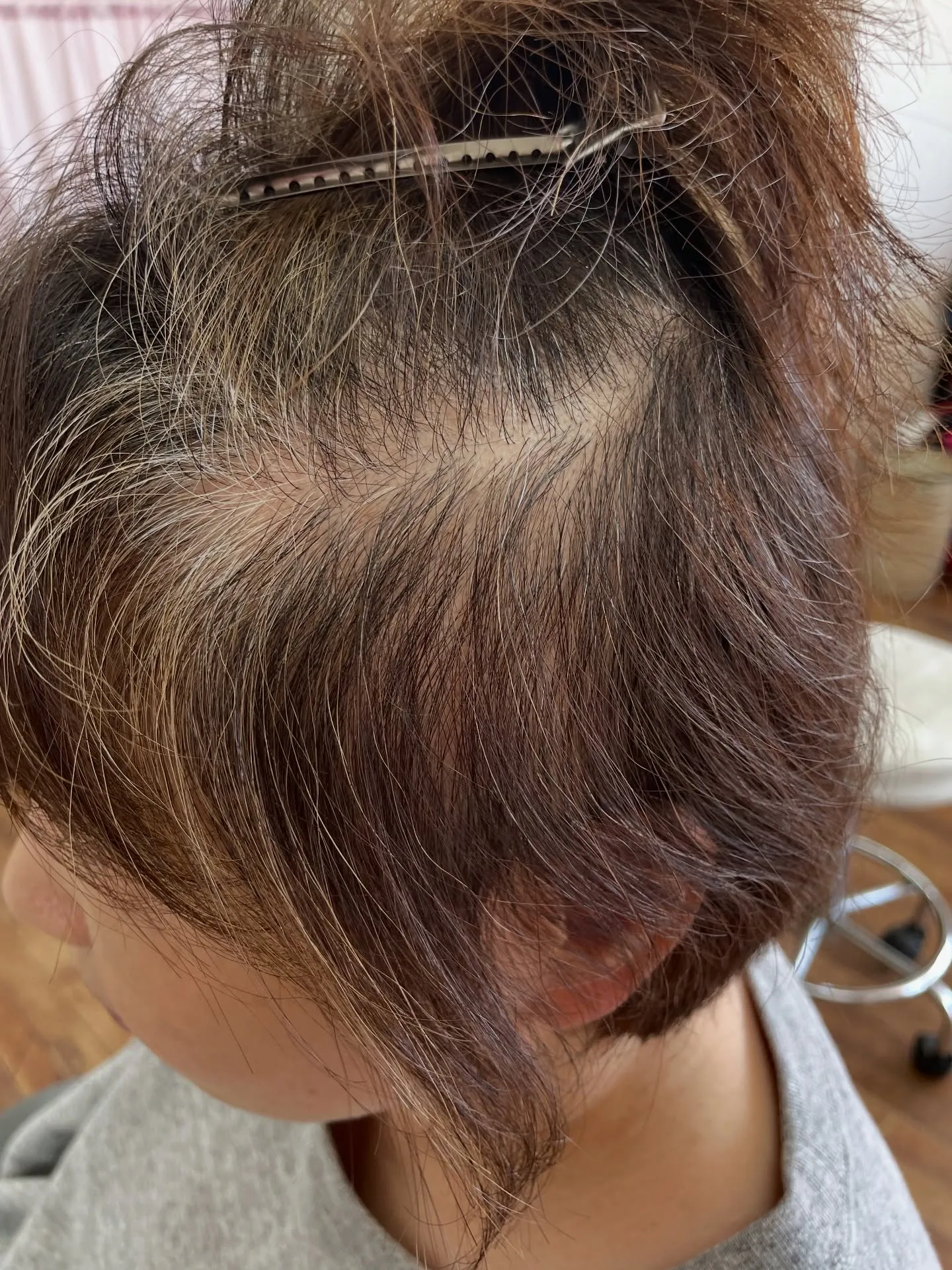 発毛ヘッドスパをされにこられました♪ホームケアがとても大切な...